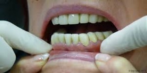 dentition